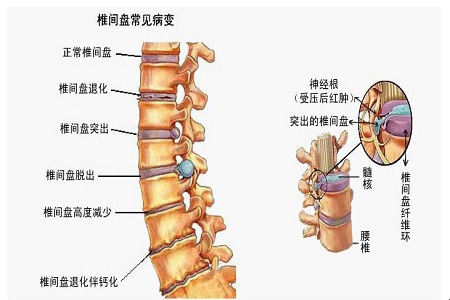 1448856160305949.jpg CgQCsVIZx8qACKgfAADr1oNkx7g81900.jpg