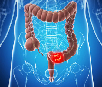 吃早餐可以預(yù)防膽結(jié)石形成的原因 吃早餐可以預(yù)防膽結(jié)石形成的原因