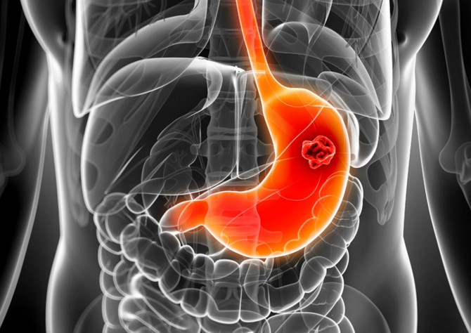 吃早餐可以預(yù)防膽結(jié)石形成的原因 吃早餐可以預(yù)防膽結(jié)石形成的原因