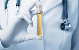 小便很黃而且有泡泡是怎么回事 小便很黃而且有泡泡是怎么回事