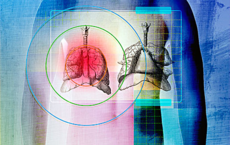 1450166270647870.png snap017.png