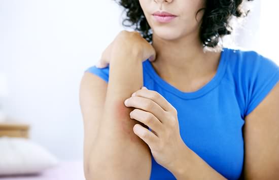 生完孩子后長蕁麻疹是怎么回事?如何治療? 生完孩子后長蕁麻疹是怎么回事?如何治療?