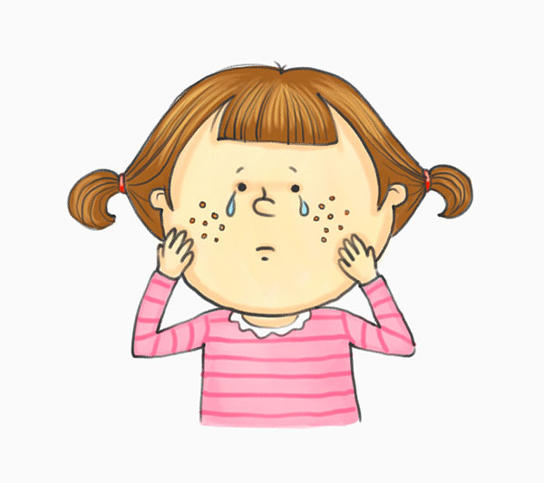 麻疹的出疹順序 如何預(yù)防與飲食 麻疹的出疹順序 如何預(yù)防與飲食