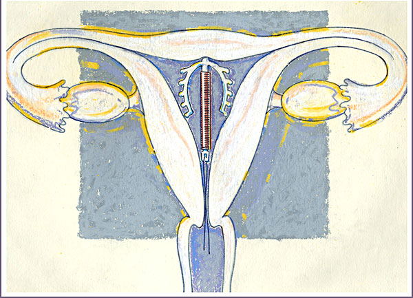 子宮肌瘤有什么癥狀嗎 自然醫(yī)學(xué)治療促排毒 子宮肌瘤有什么癥狀嗎 自然醫(yī)學(xué)治療促排毒