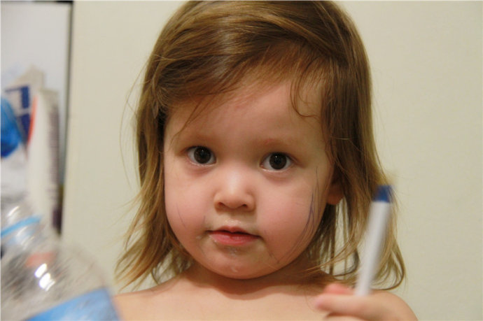 8歲女孩長(zhǎng)紅色胡子 主要原因竟然是這個(gè) 8歲女孩長(zhǎng)紅色胡子 主要原因竟然是這個(gè)