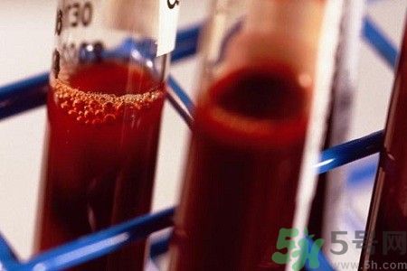 貧血的癥狀 貧血的人吃什么補(bǔ)血最快? 貧血的癥狀 貧血的人吃什么補(bǔ)血最快?