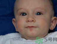 寶寶便秘拉出血怎么辦吃什么好.png 寶寶便秘拉出血怎么辦吃什么好.png