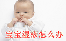 嬰兒干性濕疹是因?yàn)闊岬膯?干性濕疹如何止癢