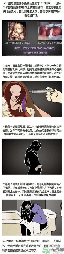 墮胎手術(shù)的可怕細(xì)節(jié) 墮胎手術(shù)的可怕細(xì)節(jié)