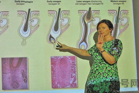 女性掉頭發(fā)很厲害是什么原因？掉頭發(fā)怎么辦？