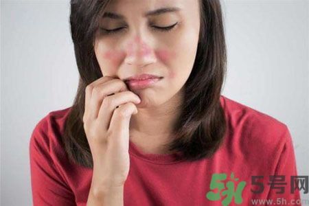 皮膚又紅又癢怎么辦？酒糟皮膚怎么治？