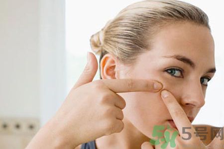 牙膏可以祛痘嗎？牙膏可以祛黑頭嗎？