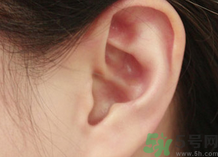 耳朵爬進(jìn)蟲子怎么辦?耳朵爬進(jìn)蟲子是什么感覺?.png 耳朵爬進(jìn)蟲子怎么辦?耳朵爬進(jìn)蟲子是什么感覺?.png