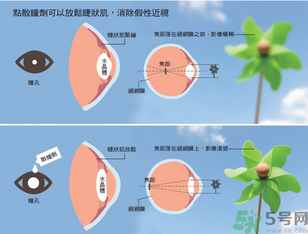 假性近視可以矯正嗎?怎么預(yù)防假性近視?.png 假性近視可以矯正嗎?怎么預(yù)防假性近視?.png