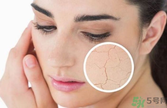 皮膚起皮怎么辦？皮膚起皮用什么護(hù)膚品？