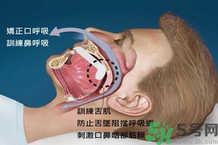 耳鳴是什么原因引起的？耳鳴怎么治療最好？