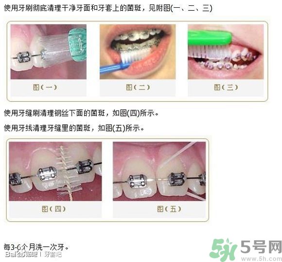 18歲還能戴牙套嗎？戴牙套真的能瘦臉改變臉型嗎？