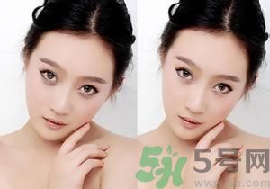 我的黑眼圈為什么是咖啡色的？怎么去除咖啡色黑眼圈？