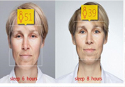 失眠會(huì)變丑嗎？失眠的人易變丑是真的嗎？