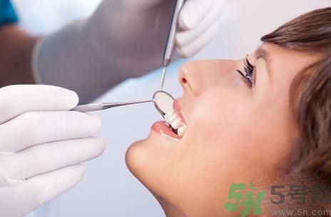 牙齒發(fā)黃怎么辦？牙齒怎么變白？