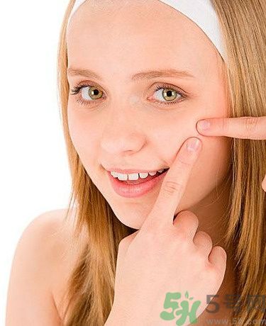 臉上有痘印怎么去除？去除痘印的小妙方？