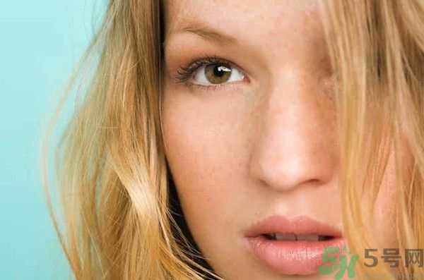 臉上有斑怎么去除？祛斑的小偏方有哪些？