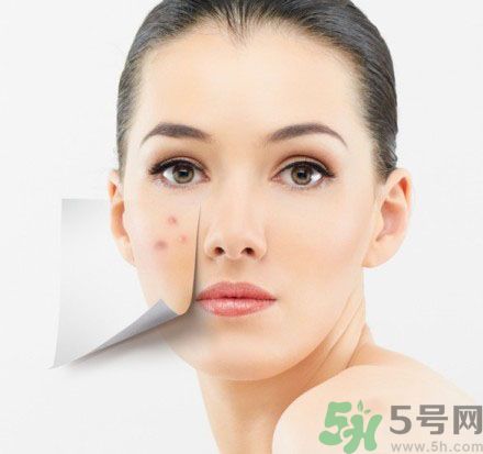 臉上有斑怎么去除？祛斑的小偏方有哪些？