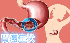 預防癌癥的食物有哪些 抗癌的十大食物