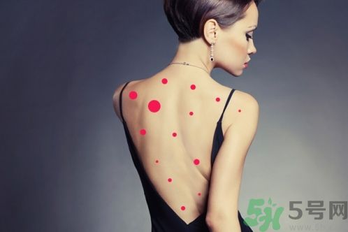 背上為什么會(huì)長(zhǎng)痘痘？長(zhǎng)痘痘怎么辦？