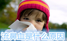 流鼻血會(huì)得什么病 流鼻血會(huì)遺傳嗎