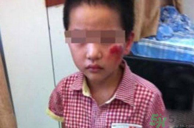 男孩遭校長暴打的結(jié)果是什么？男孩遭校長暴打的真相是什么？