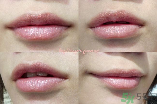 唇色發(fā)白是怎么回事？唇色發(fā)白怎么辦？