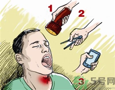 魚刺卡喉喝醋可以治療嗎？魚刺卡喉喝醋好不好？