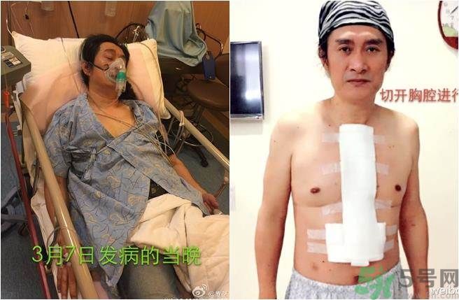 黃安重金求診歐氏管開(kāi)放癥,歐式管開(kāi)放癥是什么病癥? 黃安重金求診歐氏管開(kāi)放癥,歐式管開(kāi)放癥是什么病癥?