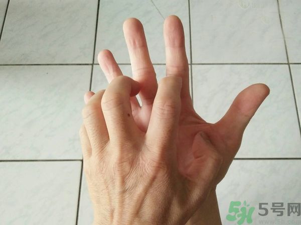 手上起水泡是什么原因？怎樣預(yù)防手上起水泡？