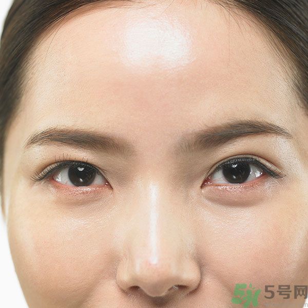 眉周紋是怎么形成的？眉周紋怎么去除？