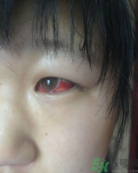 初中生全體甲醛中毒是怎么回事？初中生全體甲醛中毒是哪個(gè)學(xué)校？