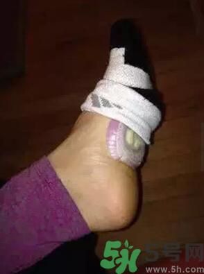 發(fā)燒可以吃洋蔥嗎？發(fā)燒能吃洋蔥嗎？