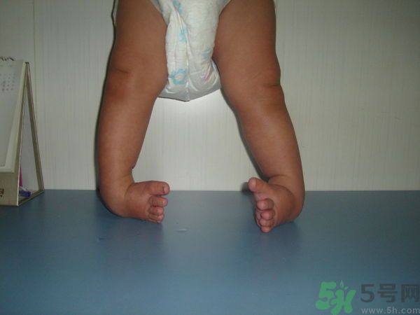 女生3天花8萬(wàn)是怎么回事？馬蹄足是什么病？