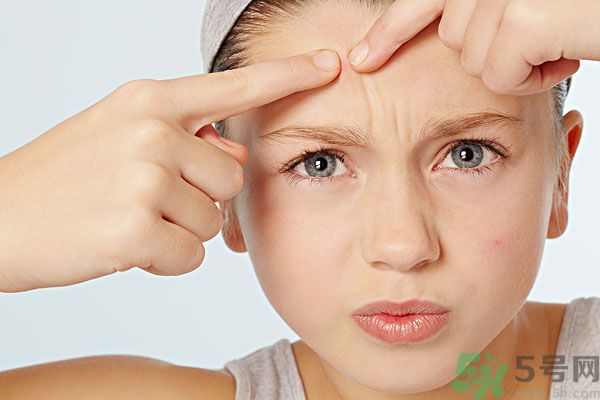 蒲公英可以祛痘嗎？蒲公英怎樣可以祛痘？