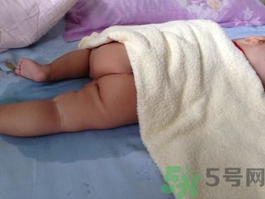 熱痱子怎么治療好的快?熱痱子癥狀圖片 熱痱子怎么治療好的快?熱痱子癥狀圖片