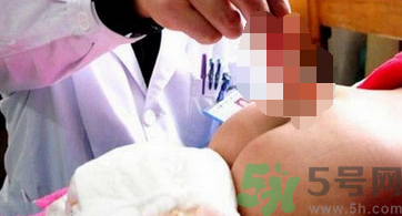 幼童屁股長出尾巴的原因是什么？孕婦缺什么幼童屁股長出尾巴？