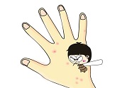 蚊子叮的包過幾天又癢是為什么？蚊子叮的包過幾天又癢怎么辦？