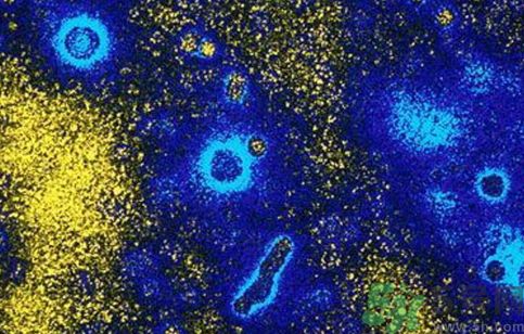 美國超級細菌現(xiàn)身 超級細菌能抵抗所有抗生素嗎? 美國超級細菌現(xiàn)身 超級細菌能抵抗所有抗生素嗎?