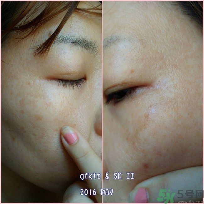 sk2祛斑精華怎么樣？skii祛斑精華使用方法