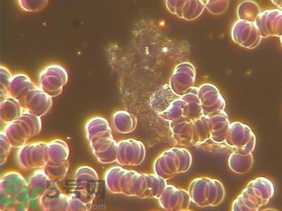 葡萄胎清宮后hcg多久能恢復(fù)正常?葡萄胎清宮后注意事項(xiàng) 葡萄胎清宮后hcg多久能恢復(fù)正常?葡萄胎清宮后注意事項(xiàng)