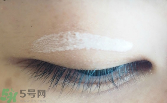 單眼皮怎么變雙眼皮了？單眼皮上面有一條線