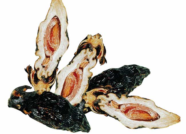 嚼檳榔的好處和壞處 嚼檳榔頭暈怎么回事？