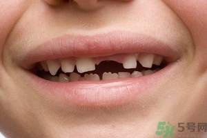 青少年牙齒松動怎么辦？青少年怎么保護牙齒？