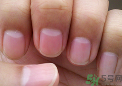 指甲沒(méi)有月牙是什么原因？指甲沒(méi)有月牙怎么調(diào)理？